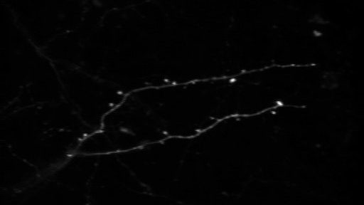 First Image of Dendritic&nbsp;Spines